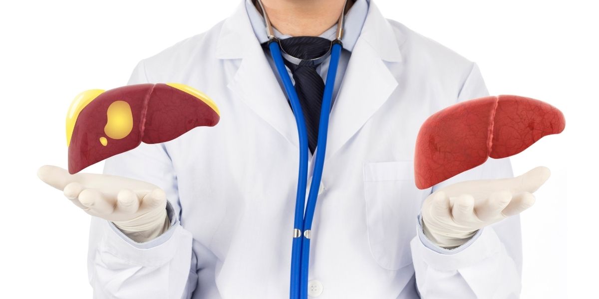 Does lecithin help with fatty liver The Longevity Lab